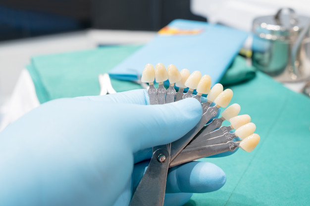 What Are Veneers for Teeth?